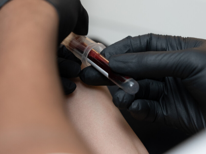 ViTOX Blood Tests and Analysis